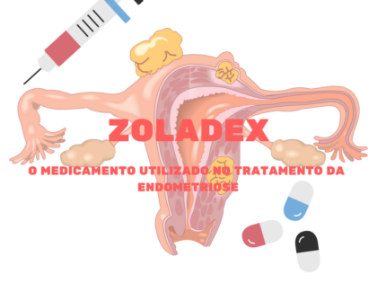 ZOLADEX: medicamento para tratamento da endometriose